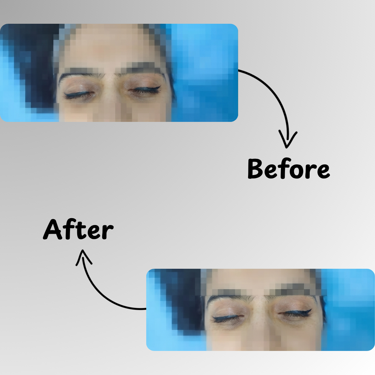 Under Eye